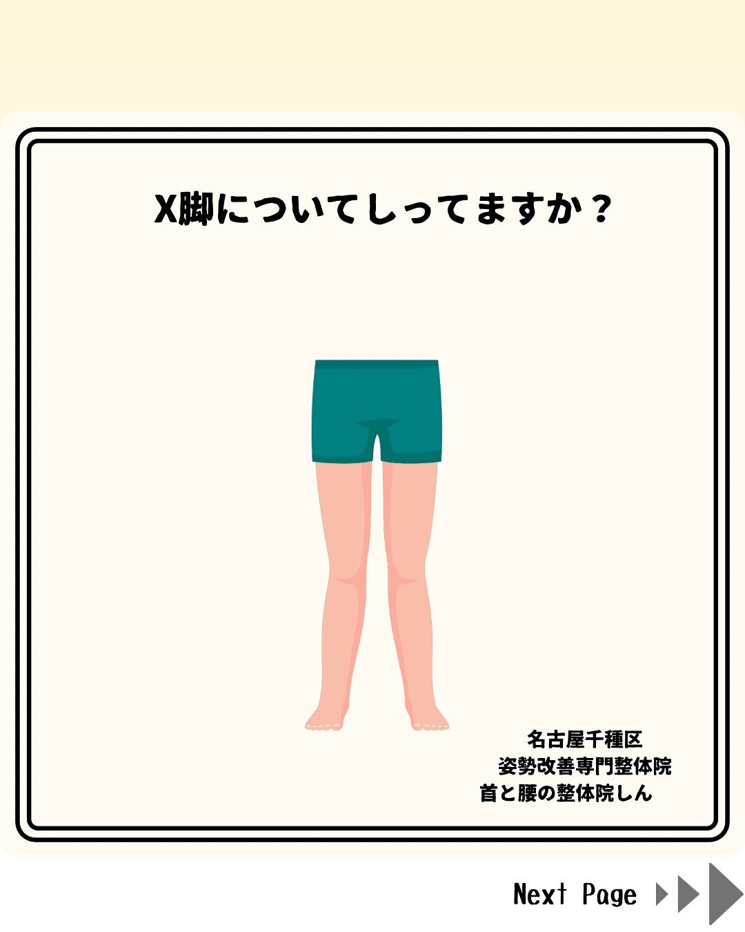 美姿勢を目指す女性必見！X脚改善で理想のスタイルを手に入れる方法