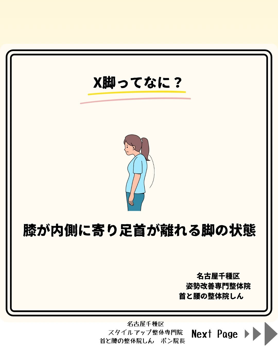 美姿勢を目指す女性必見！X脚改善で理想のスタイルを手に入れる方法