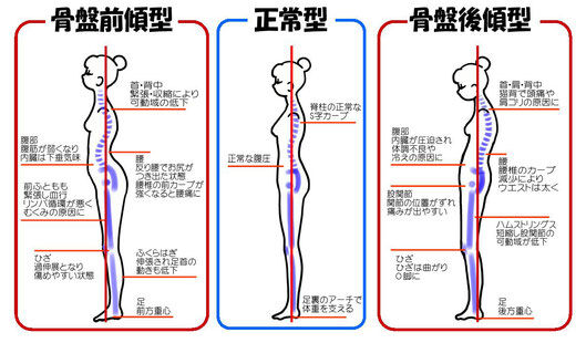 腰痛の原因